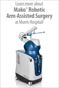 Mako Robotic Arm-Assisted Surgery machine